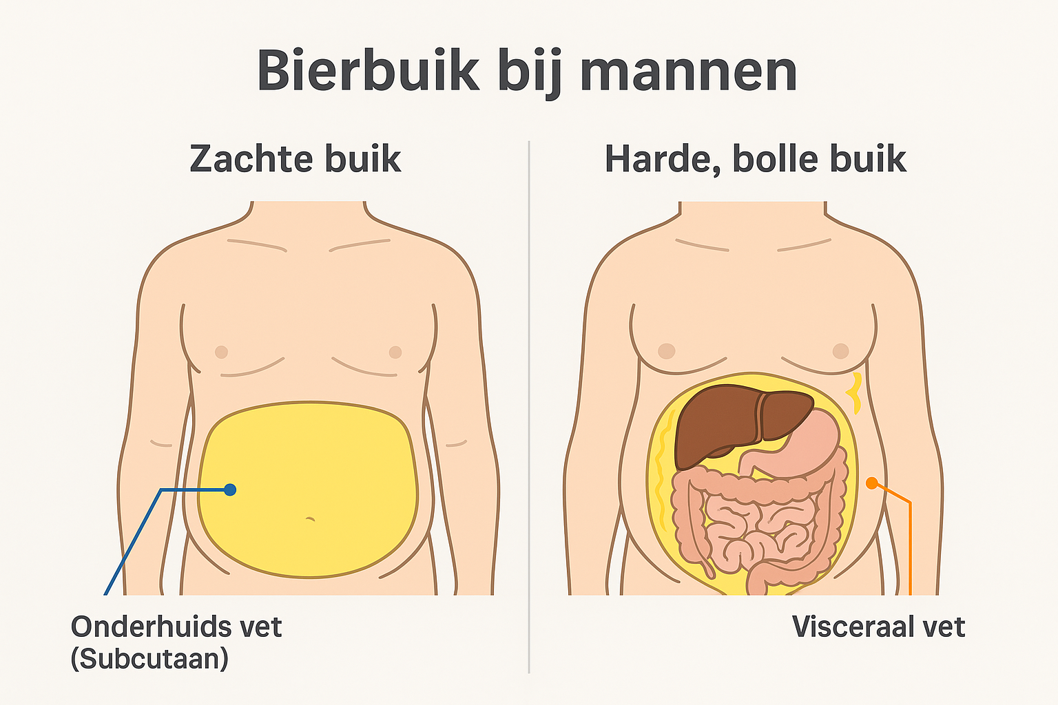 Illustratie van bierbuik bij mannen met verschil tussen onderhuids vet en visceraal vet